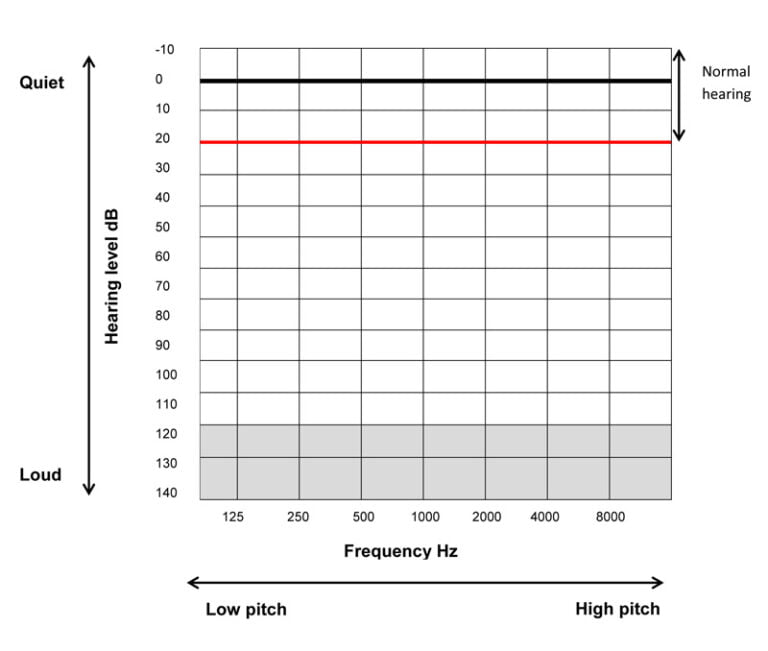 hearing test audiogram