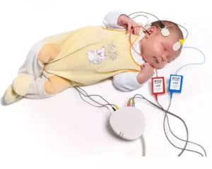 auditory-brainstem-response-abr