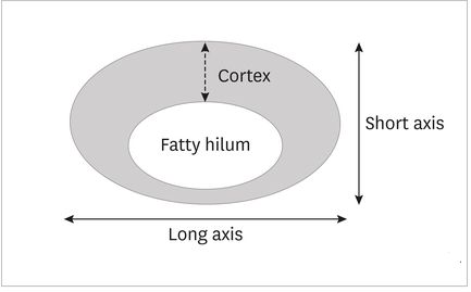 lymph_node_fatty_Hilum